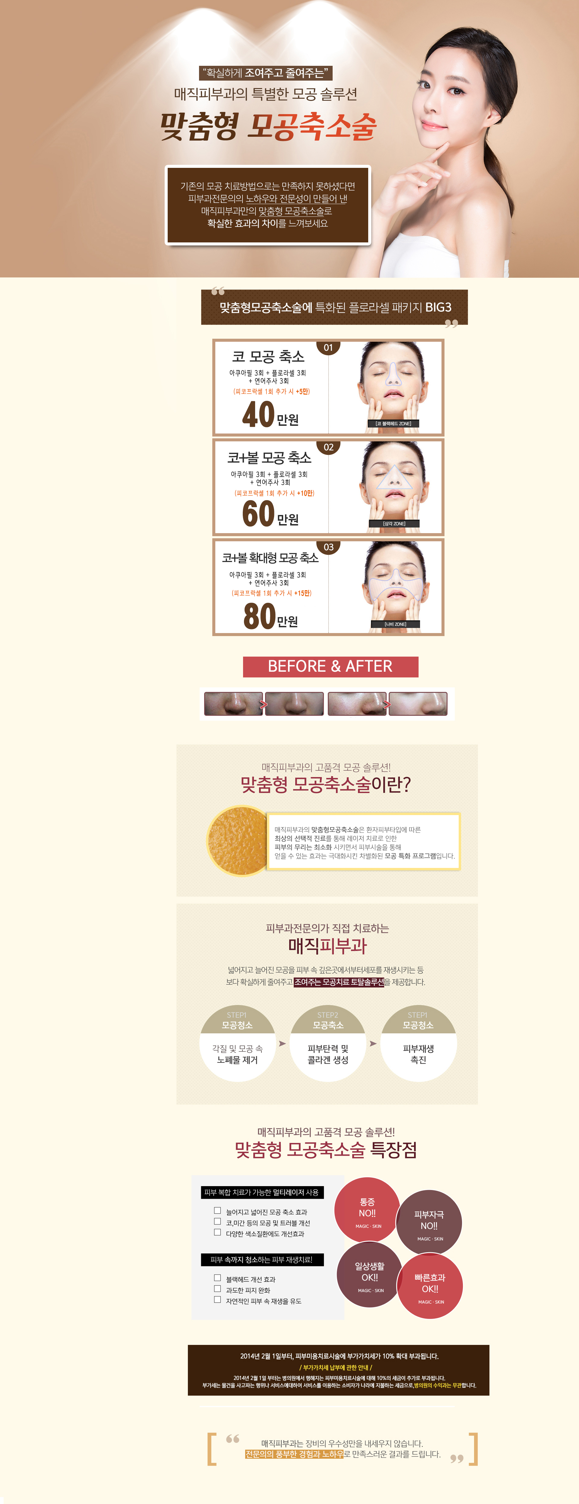 맞춤형모공축소술