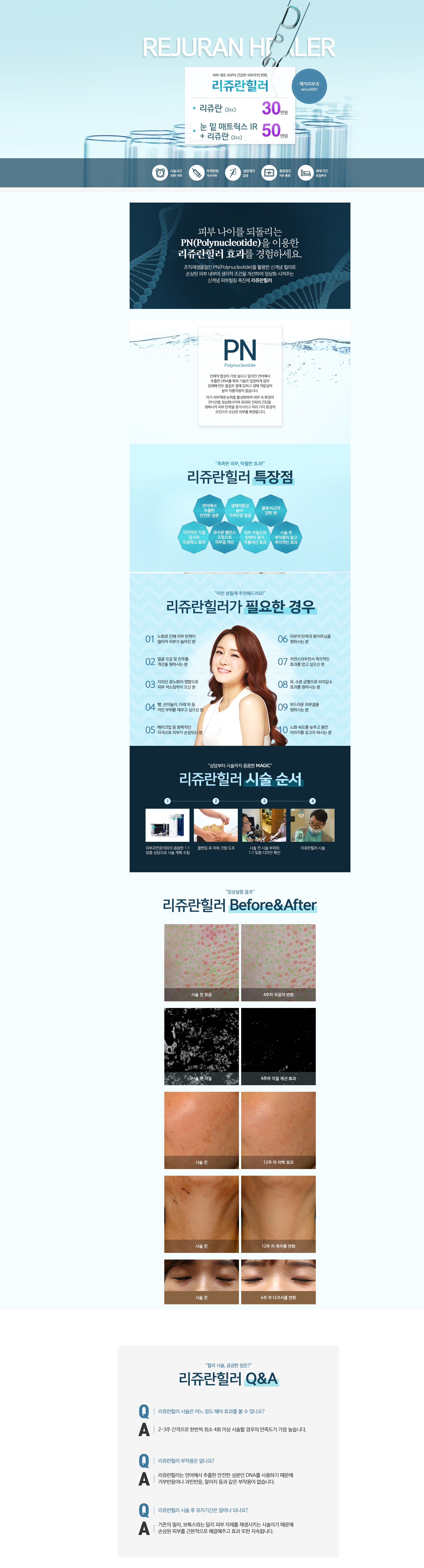 리쥬란힐러
